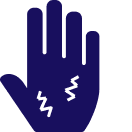 Peripheral neuropathy.